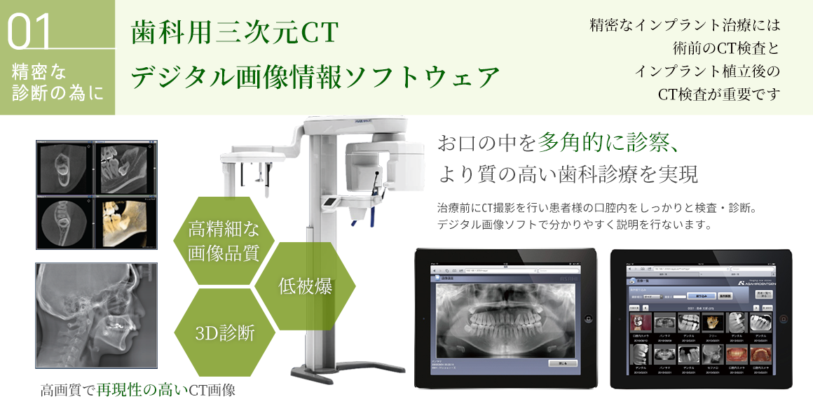 CTレントゲン