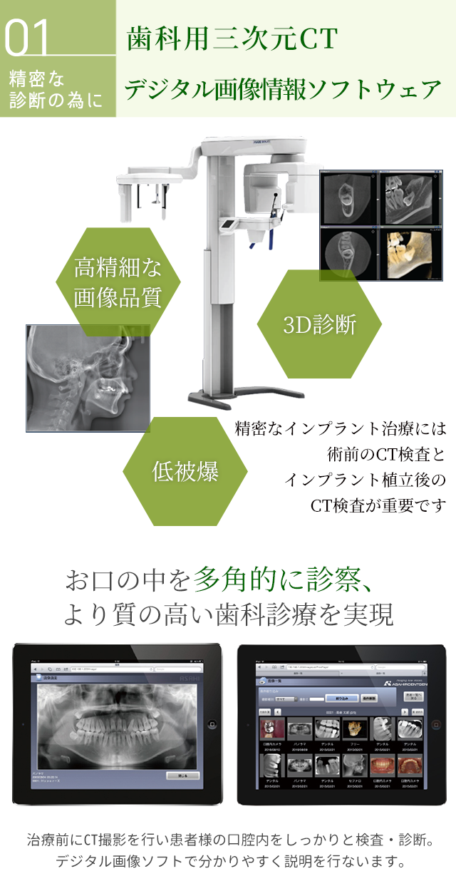 CTレントゲン