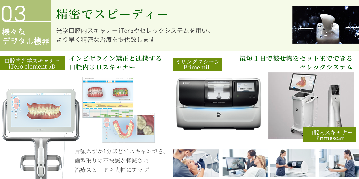 iTero cerec