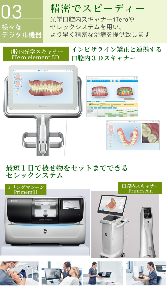 iTero cerec