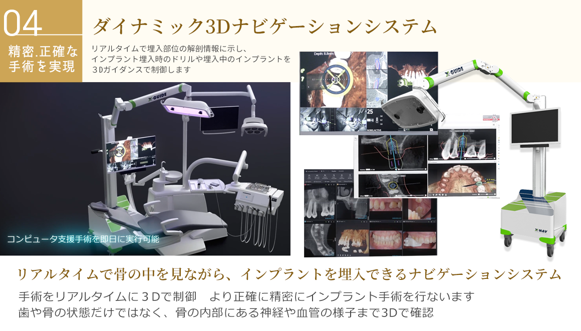 エックスガイド