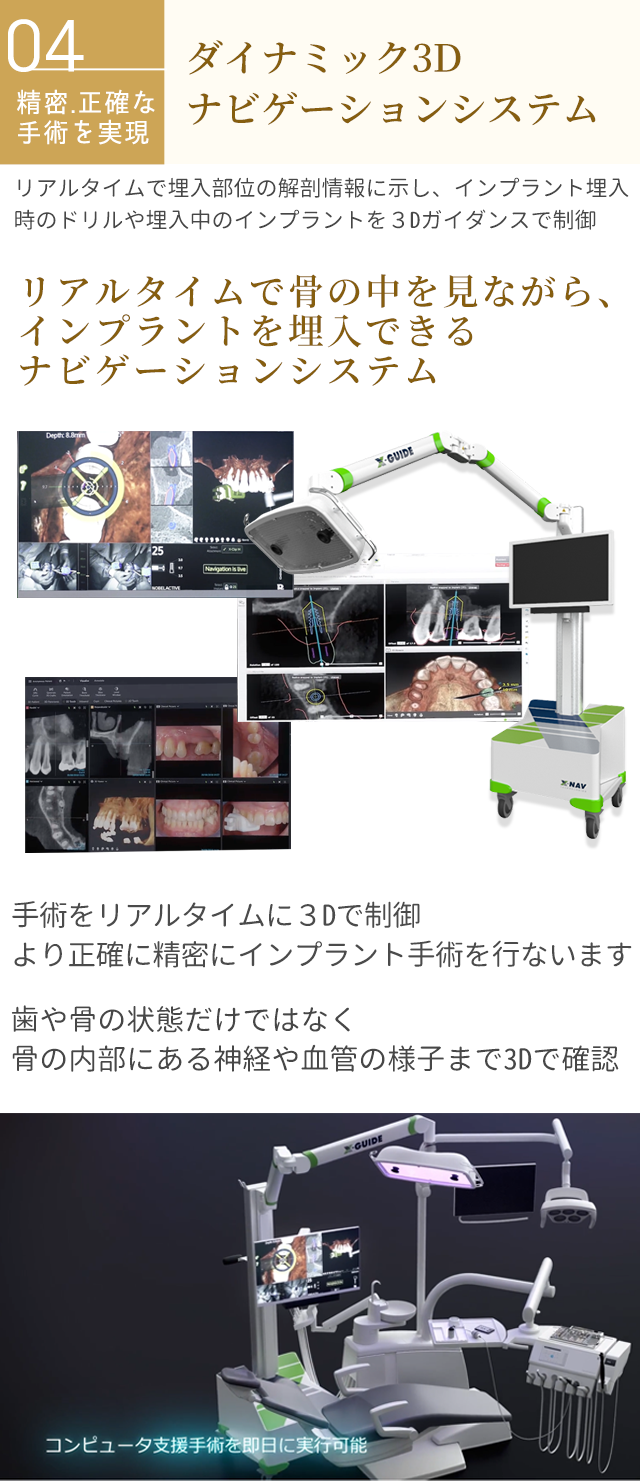 エックスガイド