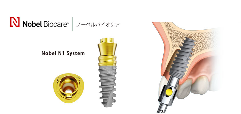 インプラントメーカー2