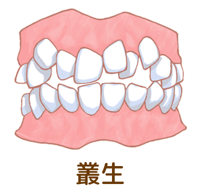 叢生