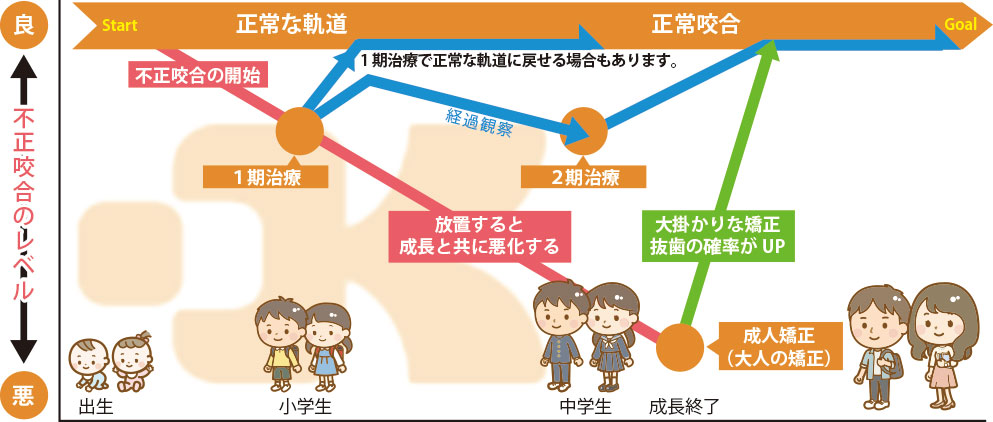 小児矯正歯科治療の進め方