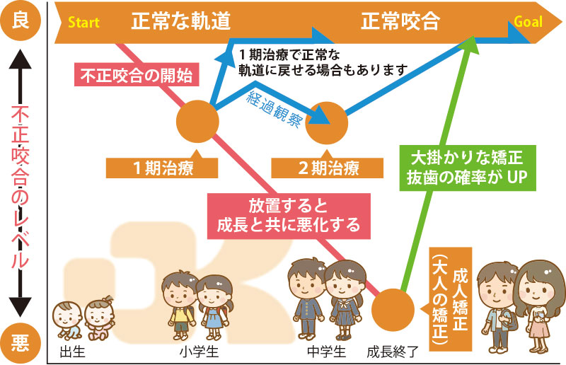 小児矯正歯科治療の進め方