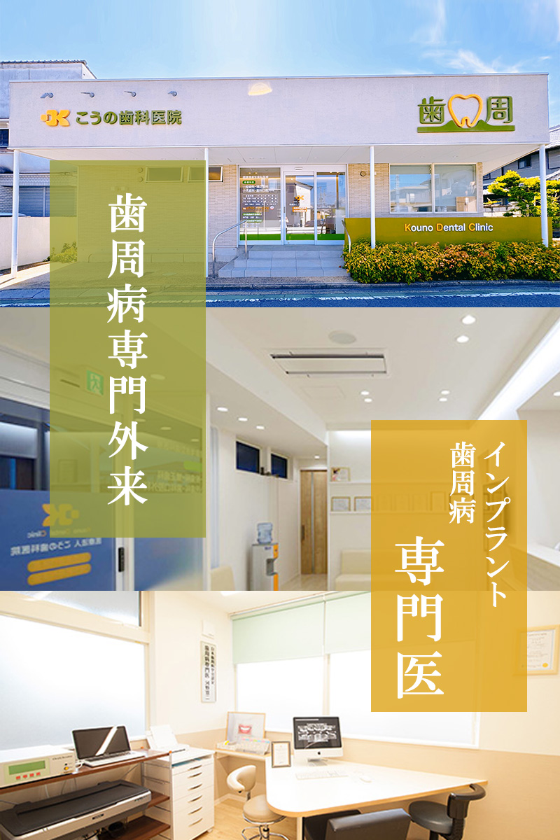 奈良県斑鳩町 歯科 歯医者 こうの歯科医院