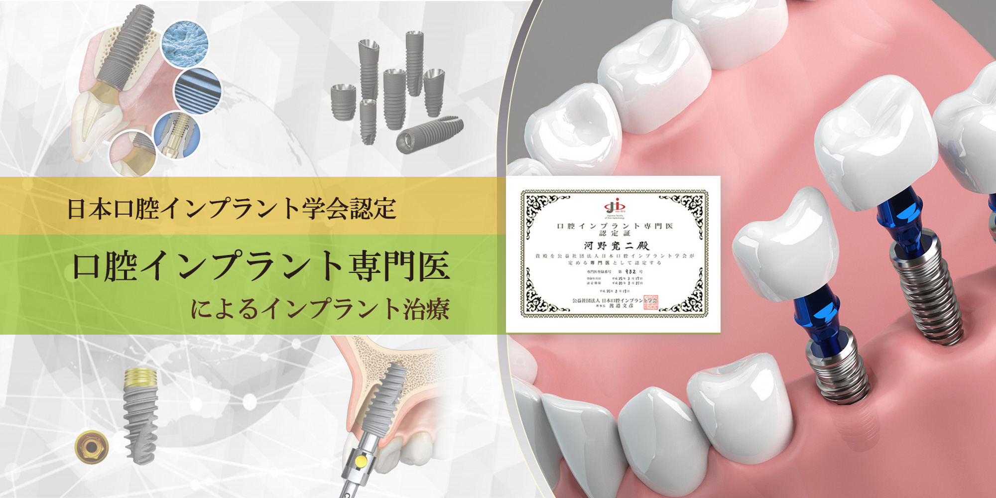 奈良県内唯一の日本歯周病学会専門医研修施設